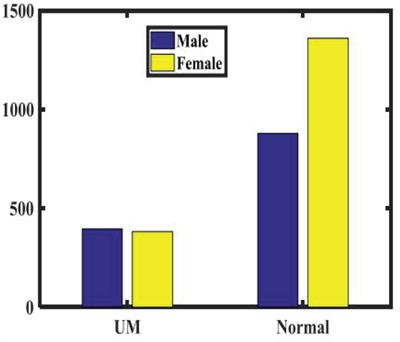 Validation of the Relationship Between Iris Color and Uveal Melanoma Using Artificial Intelligence With Multiple Paths in a Large Chinese Population